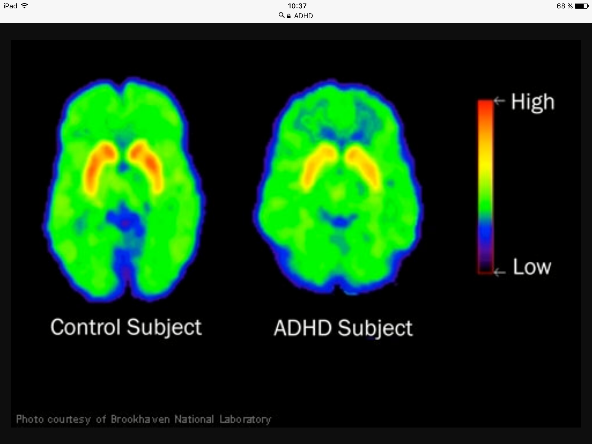 Har du ADHD/ADD