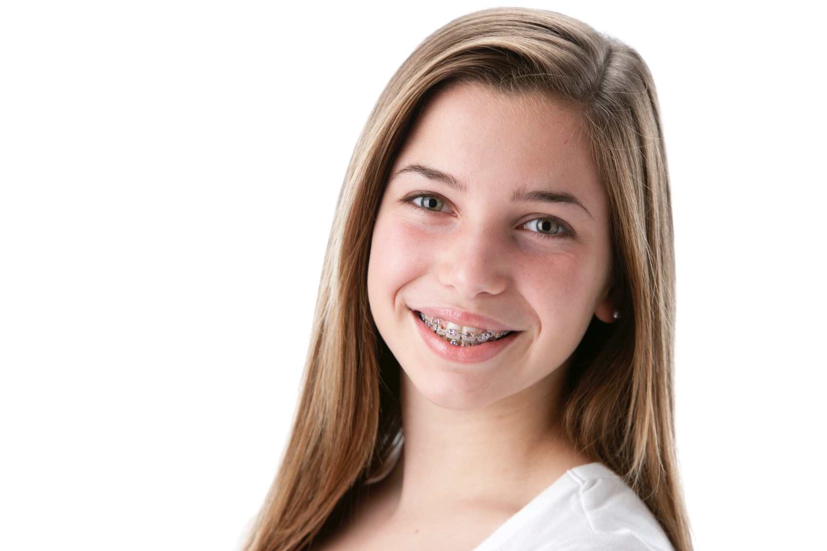 how to know if you need braces