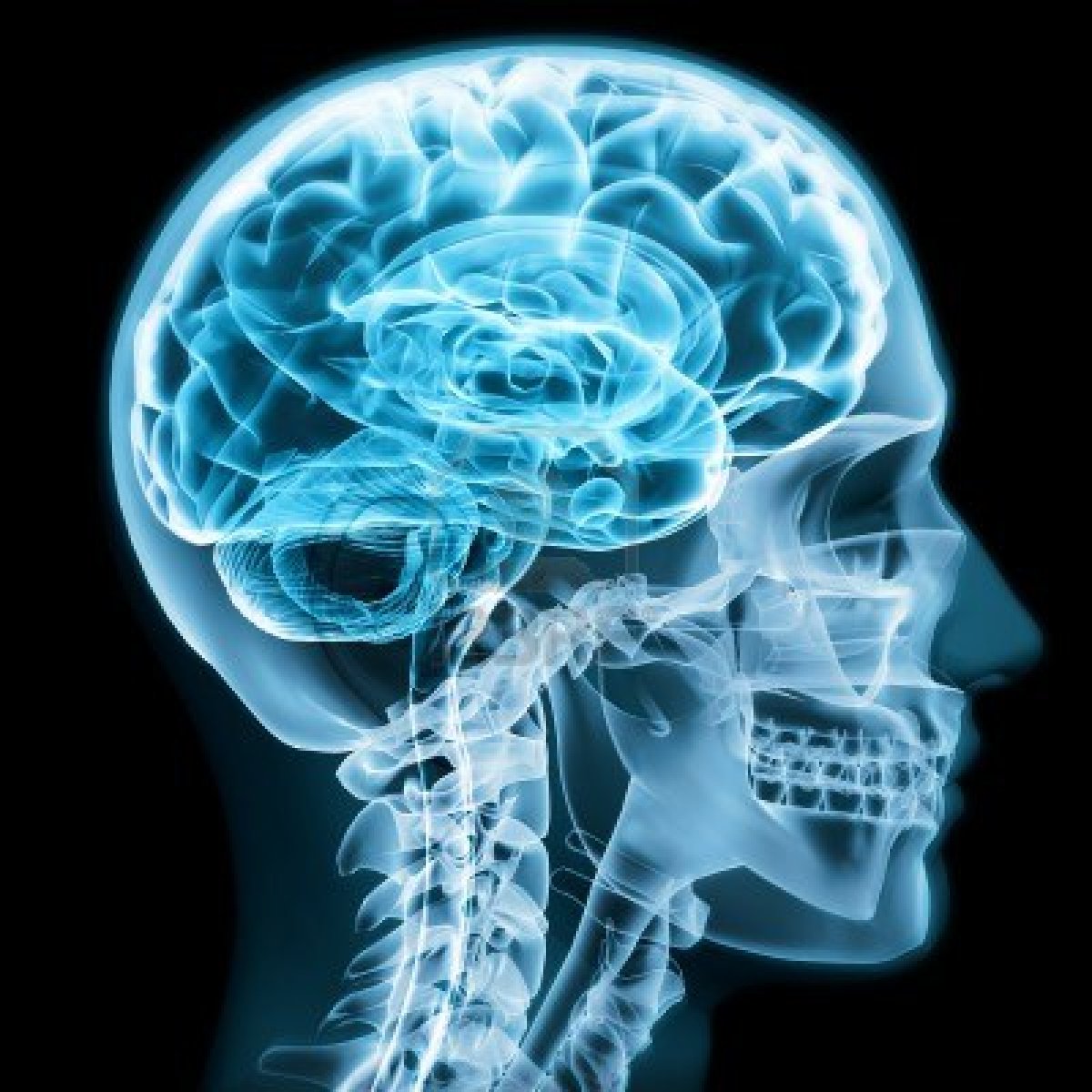 Concussion Quiz 