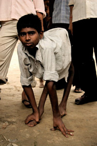 Polio Quiz