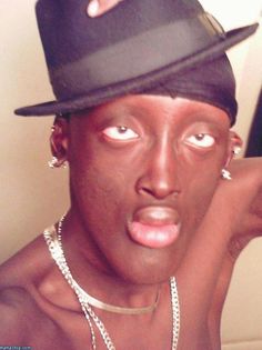 is jamartion ugly